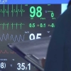 Dla wielu chorych to często jedyna szansa na życie i zdrowie. O medycznych i psychospołecznych aspektach donacji i transplantacji dyskutowano podczas konferencji w Domu Lekarza Warmińsko-Mazurskiej Izby Lekarskiej w Olsztynie.