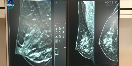 W szpitalu klinicznym MSWiA w Olsztynie otwarto nową pracownię mammografii.